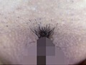 300人のまん毛 第1集　サンプル画像08